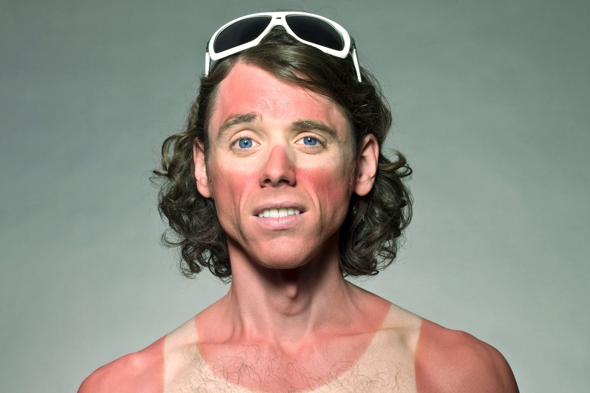 Ola de calor c mo proteger la piel