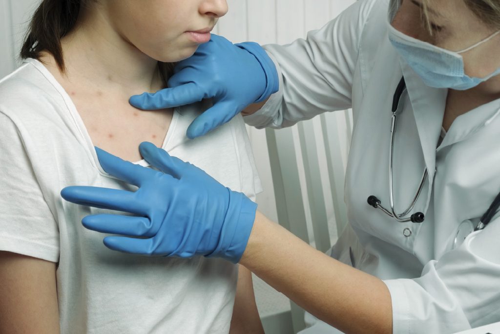 Doctora revisando a niña con sarampión
