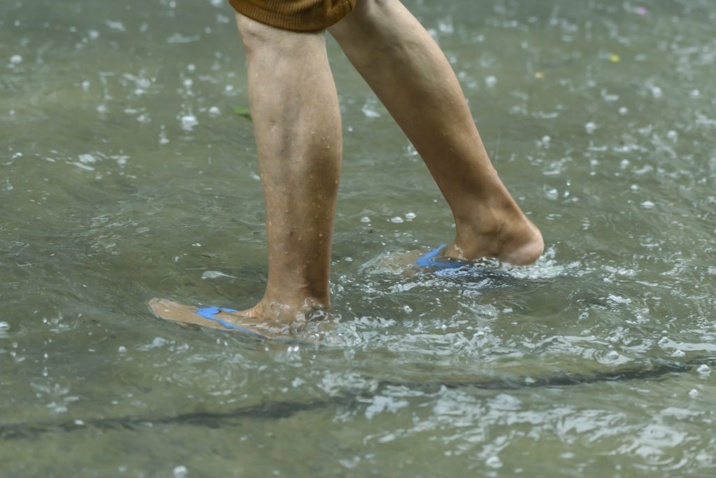 Leptospirosis: el alto riesgo que aparece con las lluvias